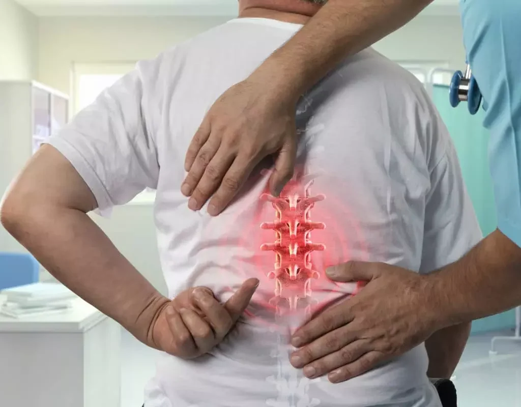 How to Get Disability for Spondylosis