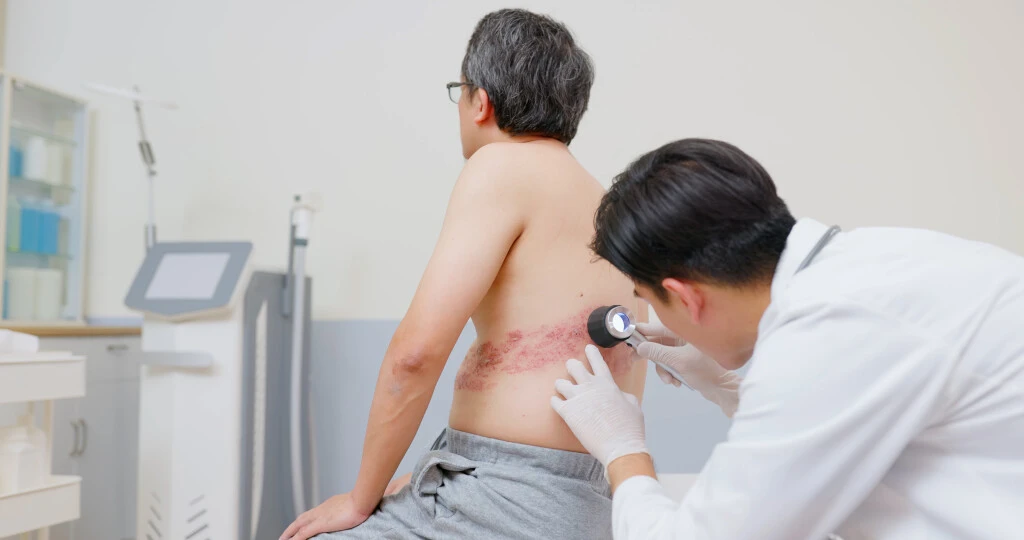 how to get social security disability for shingles