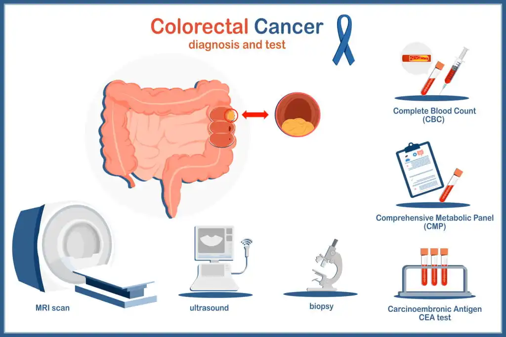 colon cancer tests, medical evidence and diagnosis